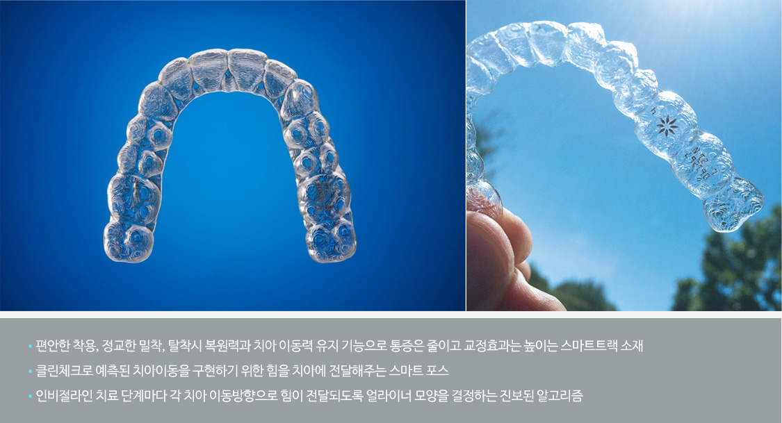 편안한 착용, 정교한 밀착, 탈착시 복원력과 치아 이동력 유지 기능으로 통증은 줄이고 교정효과는 높이는 스마트트랙 소재 / 클린체크로 예측된 치아이동을 구현하기 위한 힘을 치아에 전달해주는 스마트 포스 / 인비절라인 치료 단계마다 각 치아 이동방향으로 힘이 전달되도록 얼라이너 모양을 결정하는 진보된 알고리즘