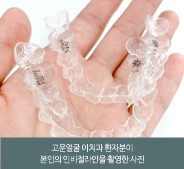 고운얼굴 이치과 환자분이 본인의 인비절라인을 촬영한 사진