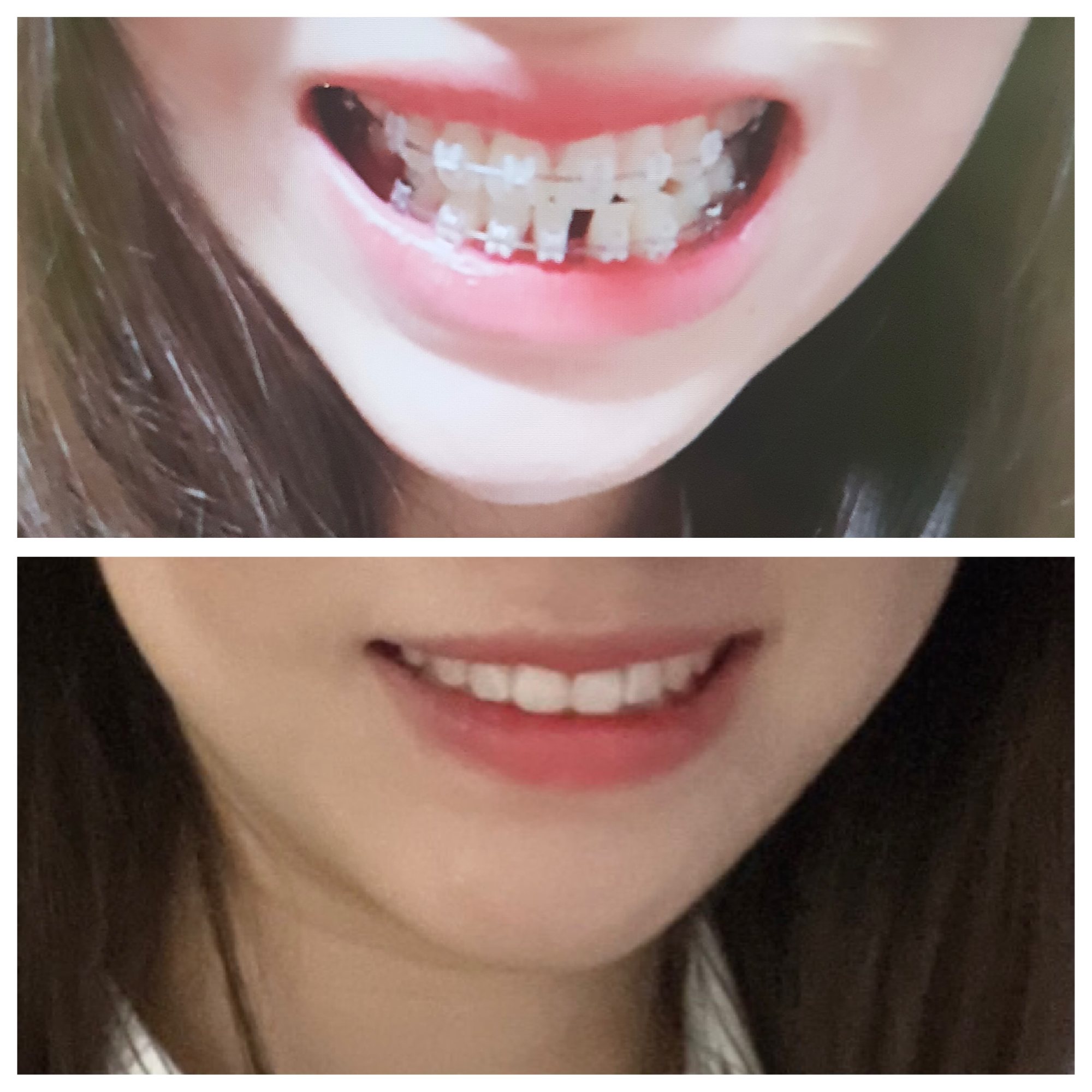치료사례