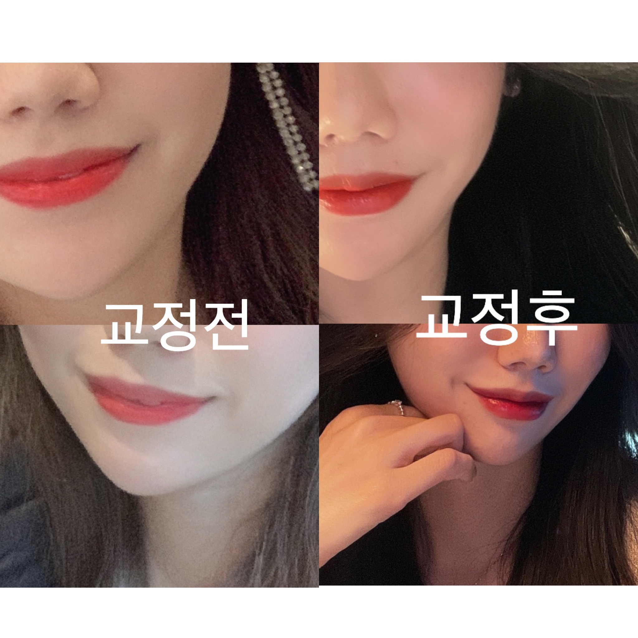 치료사례