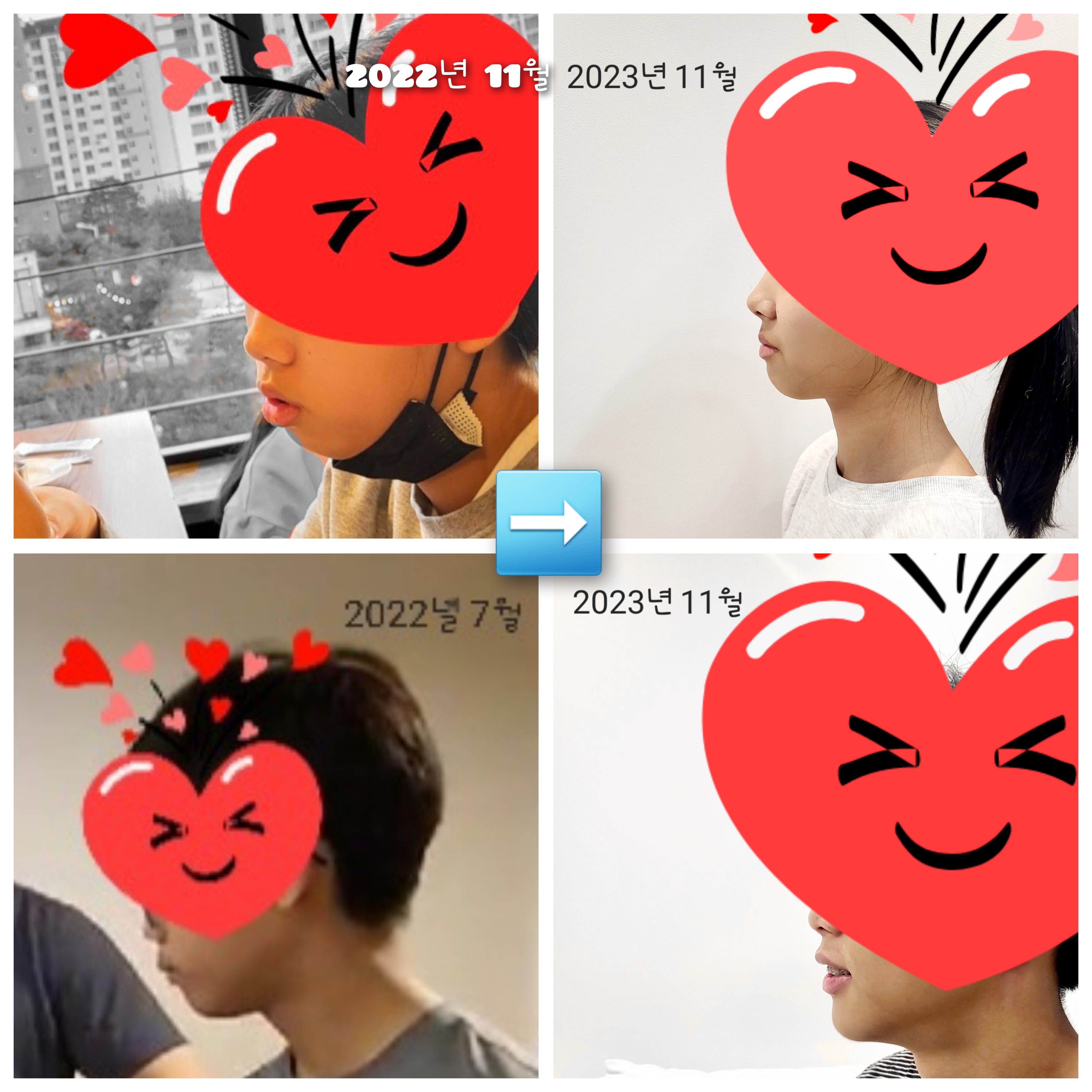 치료사례