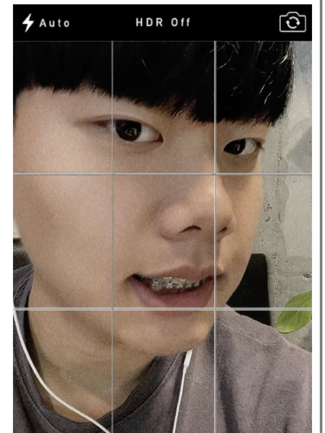 치료사례