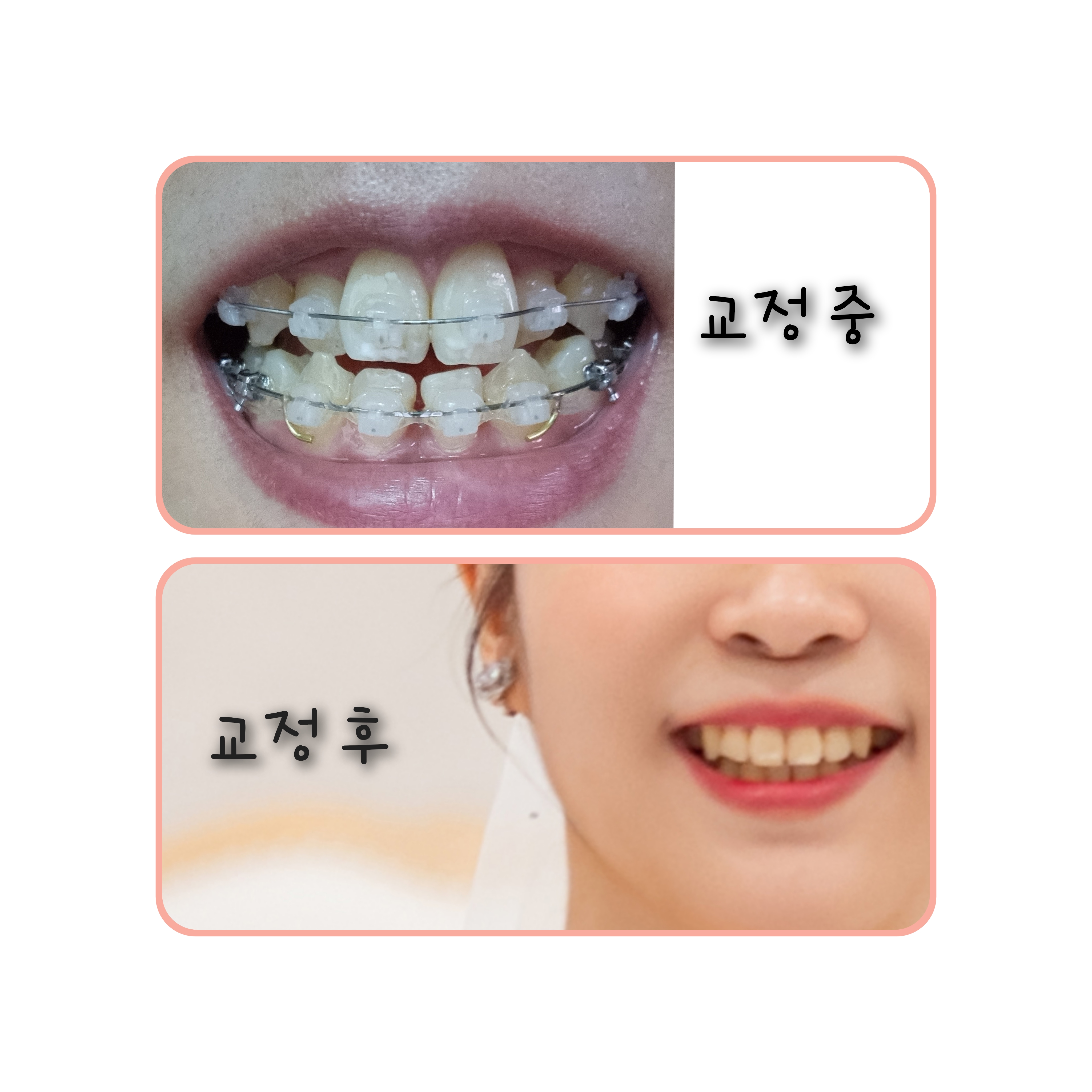 치료사례