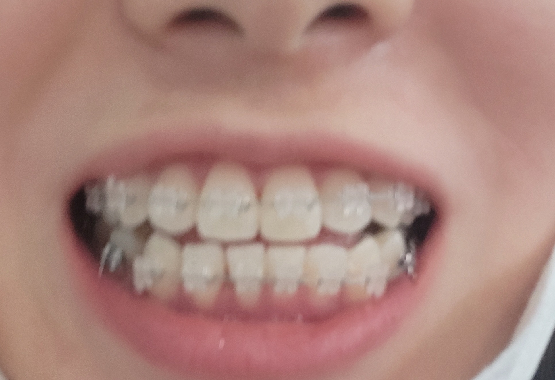 치료사례